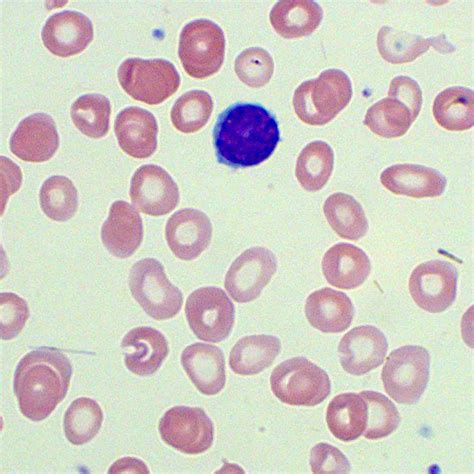 Red Blood Cell Colour Blood Film Medschool