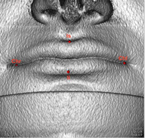 The mall was anchored by sears, lord & taylor and macy's. Location of facial landmarks chr, chl, ls, and li in the 3D rendering... | Download Scientific ...