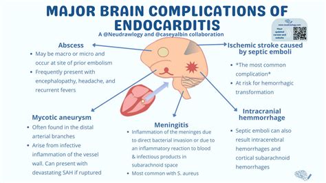 Major Brain Complications Of Endocarditis — Neudrawlogy Simplifying