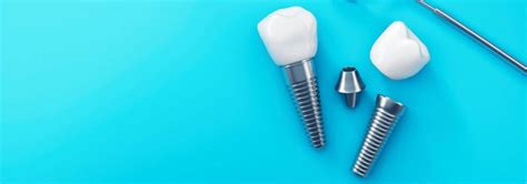 What Is The Dental Implant Success Rate Dr Motiwala Dental Clinic