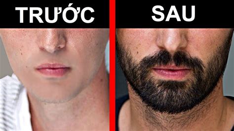 10 cách mọc râu nhanh nhất sau Đúng 1 tuần thấy kết quả tổng hợp các nội dung liên quan tốc độ