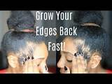 Photos of Home Remedies For Bald Edges