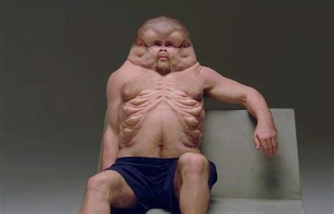 Meat is 100% safe and good for health if gentler cooking methods are used and by ensuring the visibly fatty portions of the meat are cut off and not used it is really hard to prepare a sumptuous vegetarian meal as you will require a variety of vegetables and ingredients to make a tasty meal with many. Meet Graham. If you could survive a catastrophic car crash ...