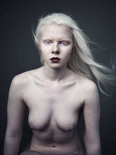 Sexy Naked Albino Girls Having Sex Adult Gallery Comments 1