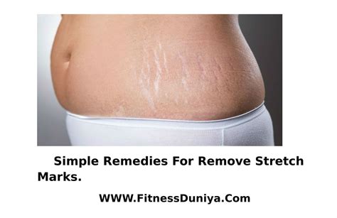 How To Clear Stretch Marks By Natural Remedies