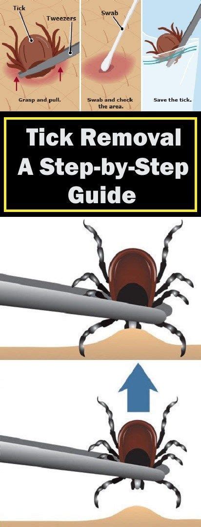 Tick Removal A Step By Step Guide Tick Removal Ticks How To Remove