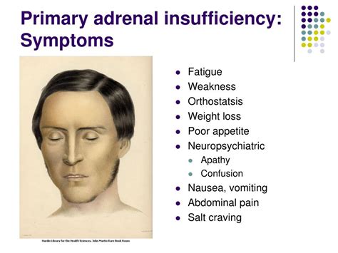 Ppt Primary Adrenal Disease Powerpoint Presentation Free Download