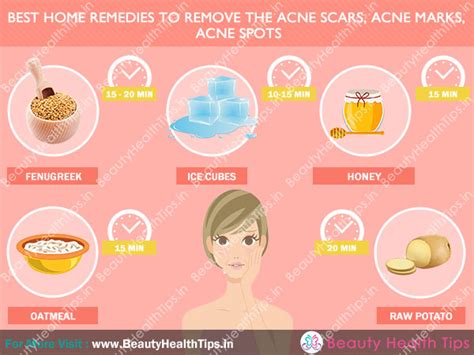 Rather than resorting to expensive medication, you can try one of these unexpected natural home remedies for acne below. hausmittel gegen pickel dampfbad 7. ssw