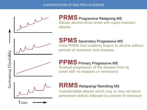 Progressive Relapsing Multiple Sclerosis | Health Life Media