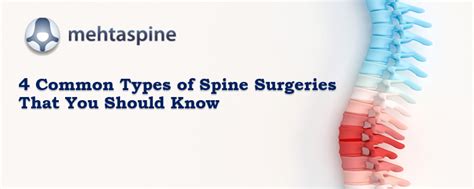 4 Common Types Of Spine Surgeries That You Should Know Mehta Spine