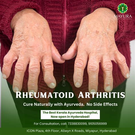 understanding rheumatoid arthritis symptoms causes and treatment options mayura ayurveda