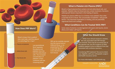 The Benefits Of Prp Injection For Injury 4 Platelet Rich Plasma Therapy Platelet Rich Plasma