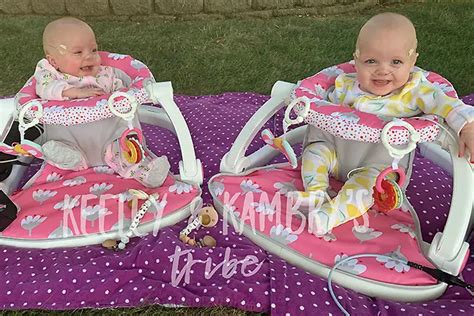 How The Worlds Most Premature Twins Have Defied The Odds To Celebrate Their First Birthday