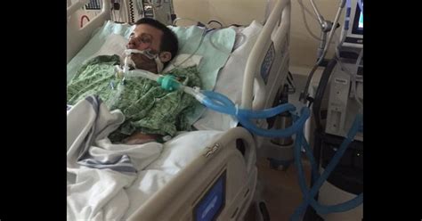 Fla Man Hospitalized After E Cigarette Explodes In Face