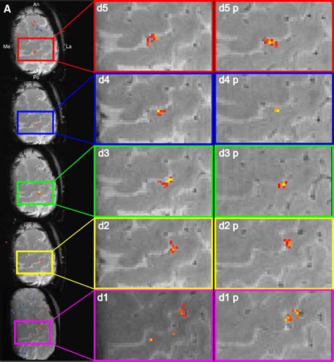 Bold Mri Activations In S1 Elicited By Tactile Stimulation Of