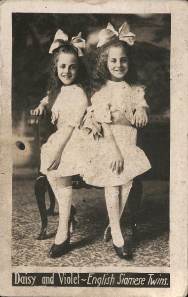 Daisy And Violet English Siamese Twins Circus Postcard