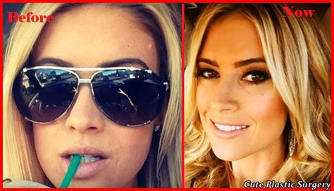 Christina El Moussa Plastic Surgery Before And After Celebrities Plastic Surgery
