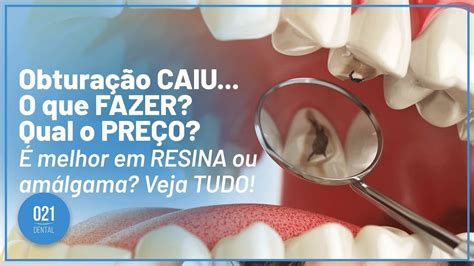 Curativo Do Canal Caiu