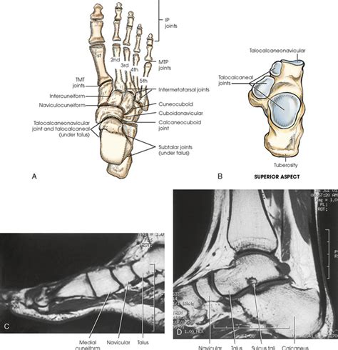 Indications for foot mri scan. LOWER LIMB | Radiology Key
