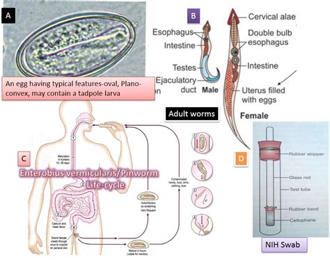 Enterobius Vermicularis Introduction Morphology Life Cycle Mode Of