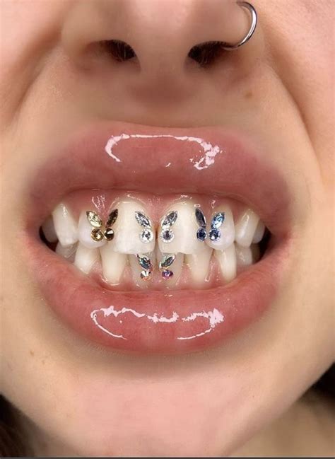 Teeth Jewel In 2021 Teeth Jewelry Tooth Gem Diamond Teeth
