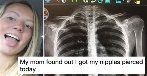 This Womans X Ray Had An Unfortunate Side Effect As Far As Her Mum Was