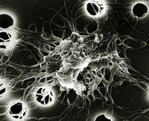 Burgdorferi exists in north america and europe and until 2016 was the only known cause of lyme disease in. Borrelia Burgdorferi