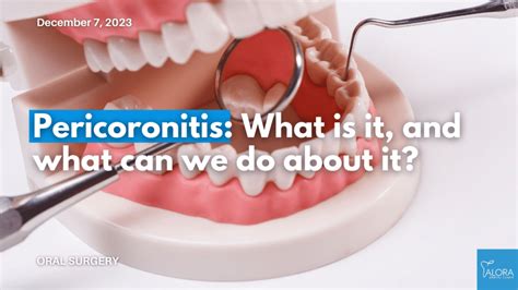 Pericoronitis Guide Symptoms Causes Treatment Alora Dental Clinic