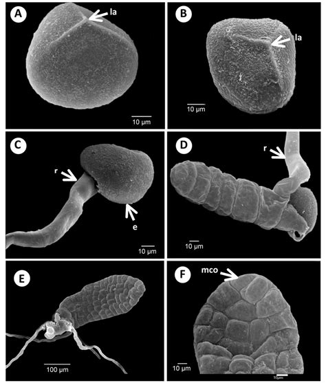 Spore Morphology Early Germination And Young Gametophytes Of
