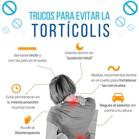 . músculo que causa la tortícolis. Tengo tortícolis y no puedo mover el cuello ¿Qué puedo hacer?