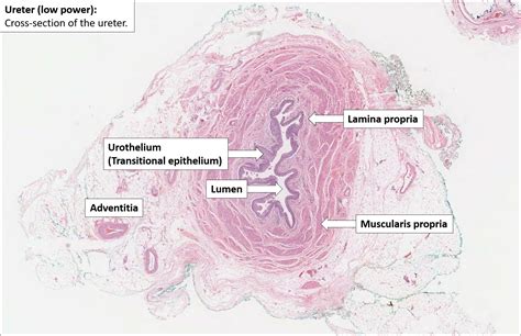 Ureter Normal Histology Nus Pathweb Nus Pathweb