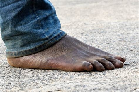 Dirty Bare Feet Stock Photos Pictures And Royalty Free Images Istock
