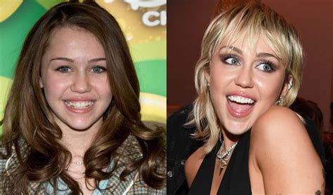 Celebrities Who Had Braces Wilkinson Orthodontics Gold Coast Orthodontist