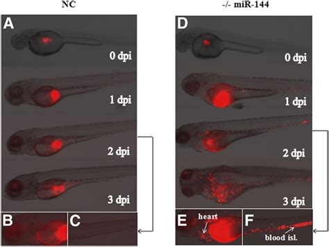 mir 144 inhibits tumor growth and metastasis in osteosarcoma via dual suppressing rhoa rock1