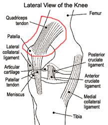 For more anatomy anatomynote.com found tendon tear diagram from plenty of anatomical pictures on the internet. Quadriceps Tendonitis Information & Treatment Advice ...