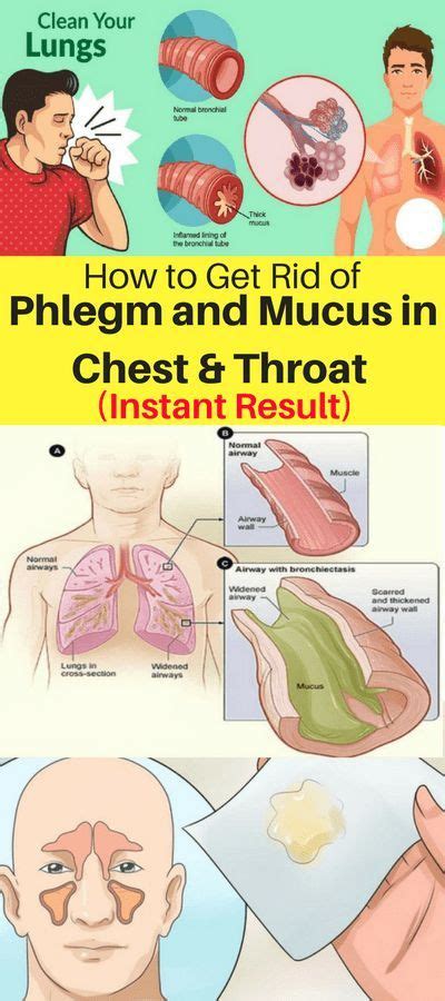 How To Get Rid Of Phlegm And Mucus In Chest And Throat Instant Result