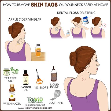 5 home remedies for skin tags tea tree oil acv and more skin tag removal remove skin tags