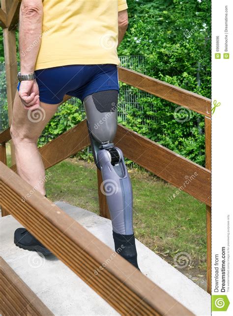 Unidentifiable Man Going Over Ramp With False Leg At Exercise Course
