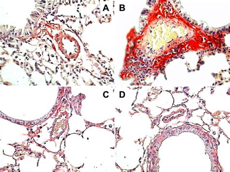 Representative Photomicrographs Of Collagen Fibers In The Pulmonary