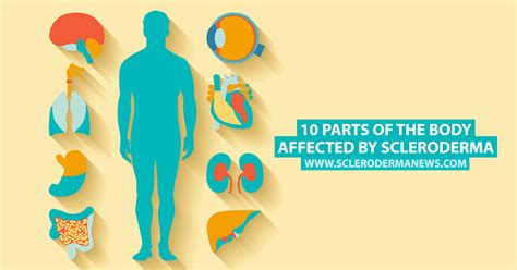 10 Parts Of The Body Affected By Scleroderma