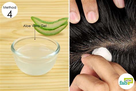 8 Best Home Remedies For Dry Flaky Scalp That Work Fab How