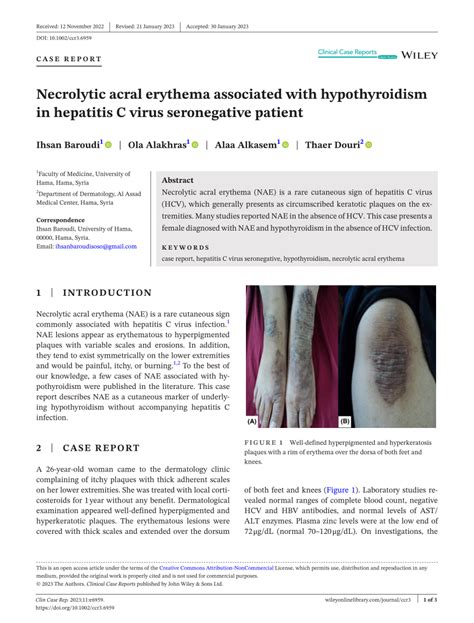 Pdf Necrolytic Acral Erythema Associated With Hypothyroidism In