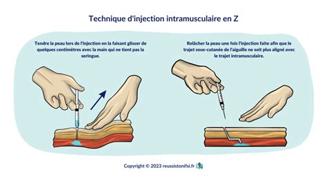Guide Pratique Des Injections Intramusculaires R Ussis Ton Ifsi