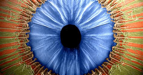 ciliary body | Medical Pictures Info - Health Definitions Photos