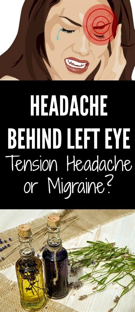 What Is A Headache Behind The Eyes Caused By Beth Mulholland Bruidstaart