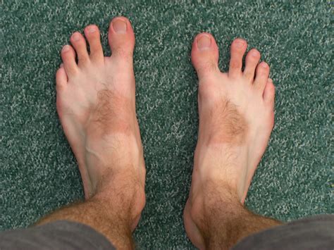 Foot Disease Doofmeuk