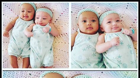 Rare Biracial Twin Girls Kalani And Jarani Are Born In Illinois Usa