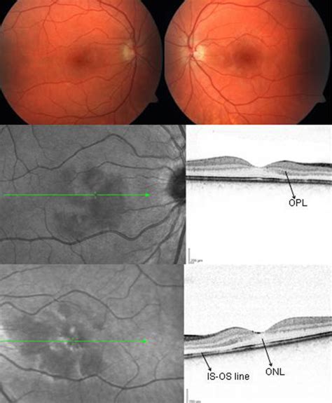 Color Fundus Photographs Download Scientific Diagram