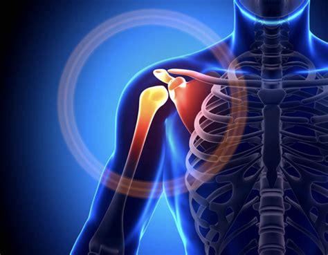 Shoulder Pain And Physical Therapy How Can We Help You C O R E