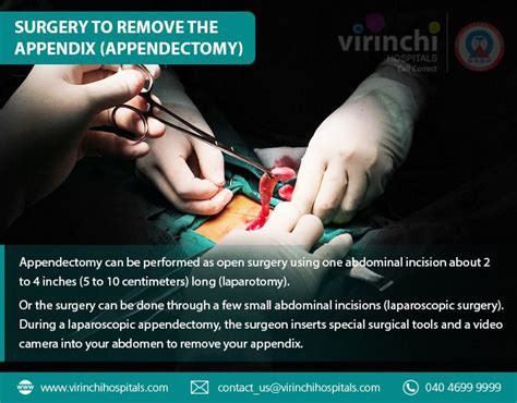 Surgery To Remove The Appendix Appendectomy Laparoscopic Surgery
